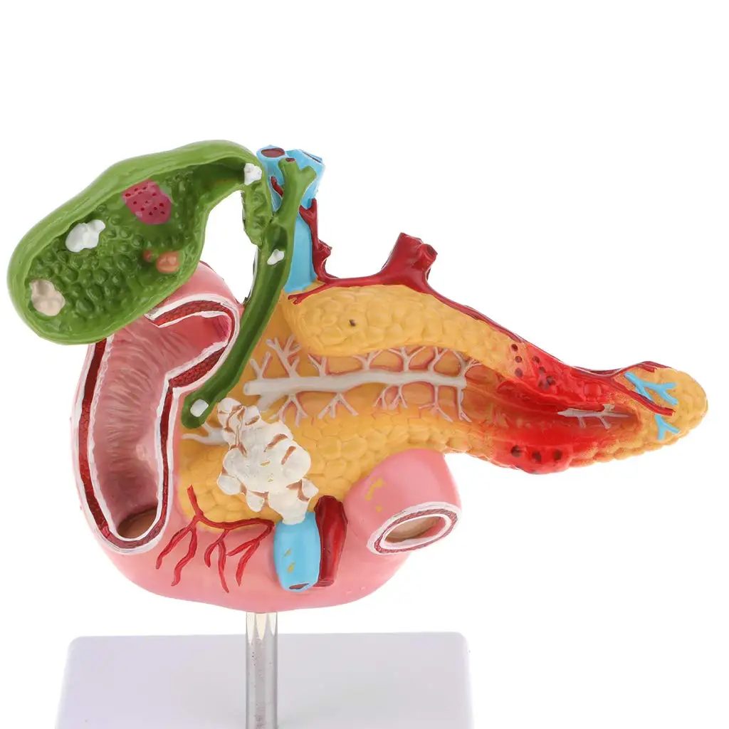 Human Stomach Model - Anatomical Accurate Stomach, Duodenum, And
