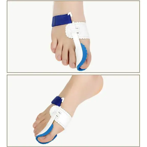 Kesoto 1Pair Night Sleeping Splint Big Toe Straightener Bunion Hallux Valgus Correctors Treat Pain in Hallux Valgus High Quality