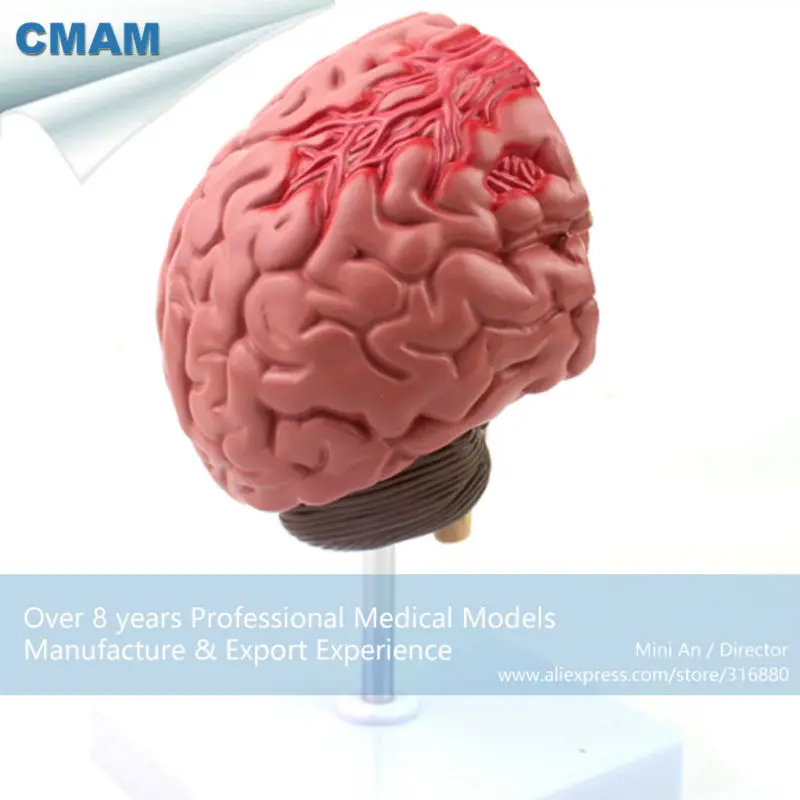 CMAM-BRAIN10 Медицинский Анатомический Мозг Модель Болезни, анатомические Модели Мозговой Артерии Порок