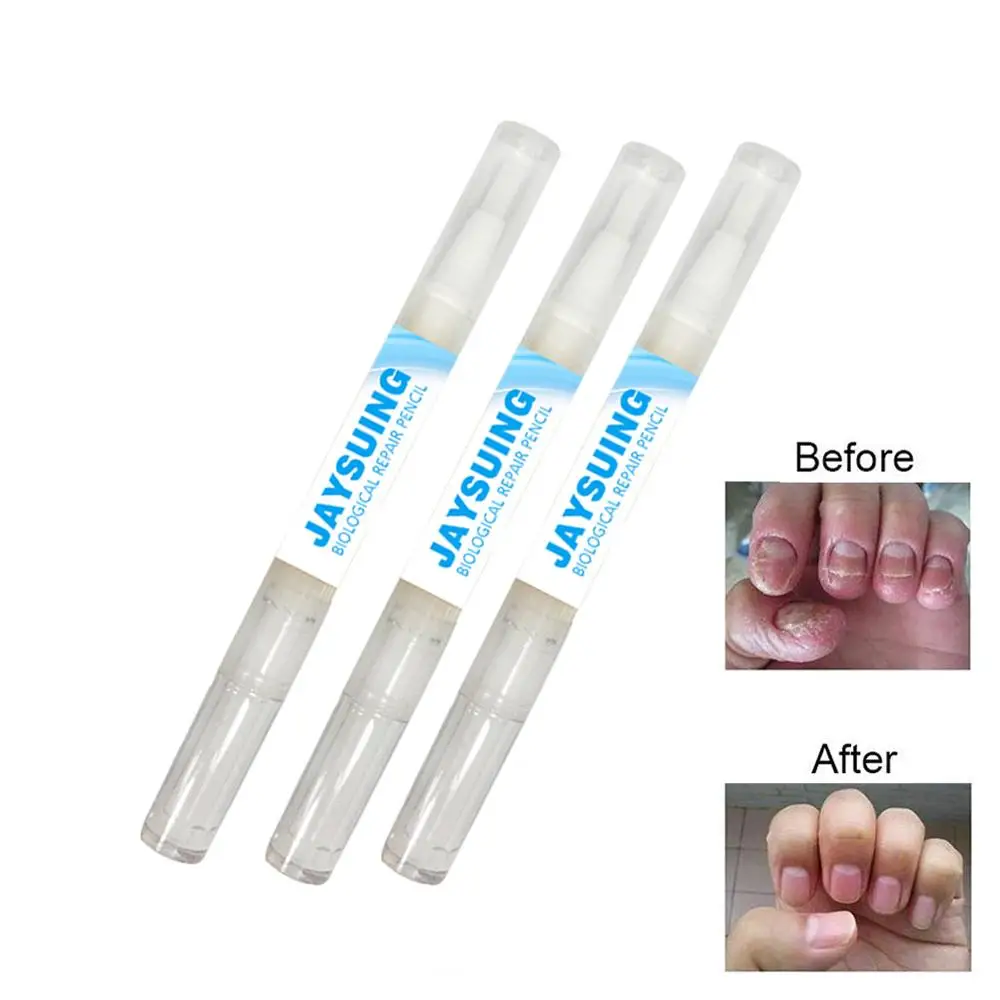 Cheap Offer of  Fungal Nail Treatment Pen Effective Onychomycosis Paronychia Fungus Infection Repair Gel Fingernail