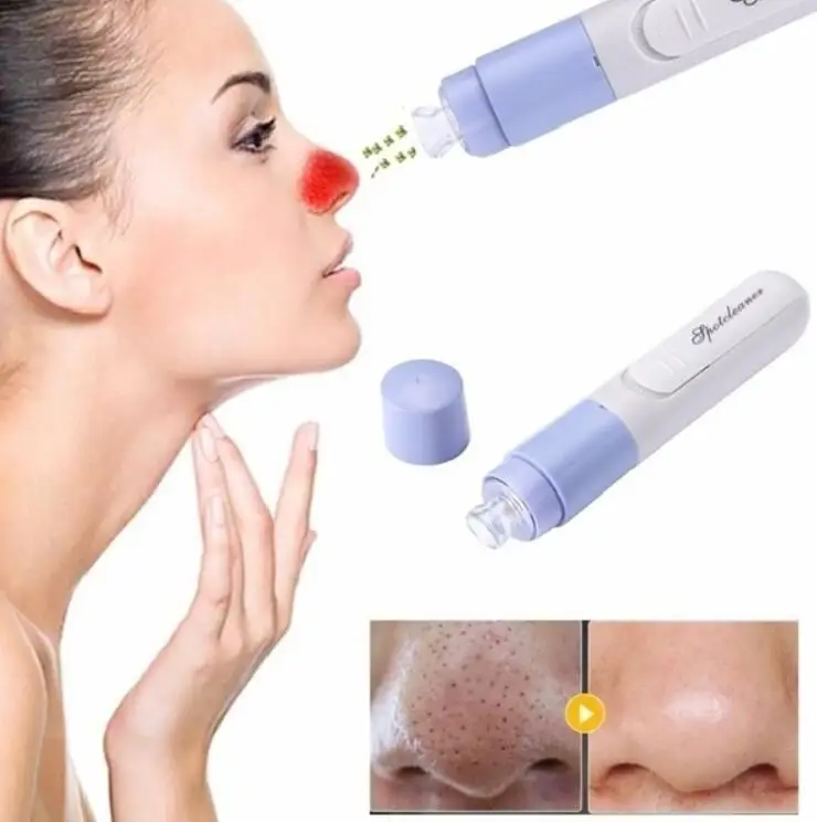 

Skin Care Pore Blackhead Remover Acne Pimple Removal Suction Extractor Tool Face Clean Facial Cleaning Machine Mini Portable