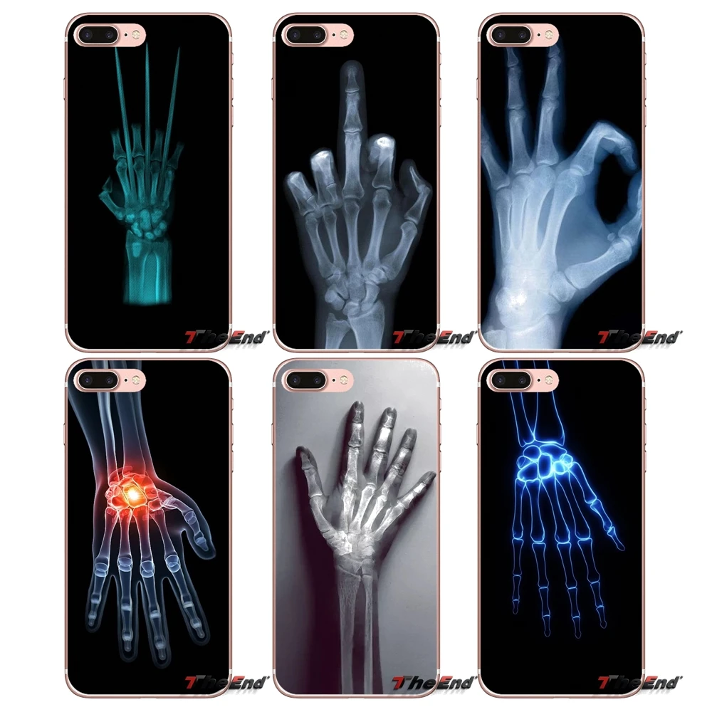 

Wolverine X-ray Hand Bones Silicone Case For iPhone X 4 4S 5 5S 5C SE 6 6S 7 8 Plus Samsung Galaxy J1 J3 J5 J7 A3 A5 2016 2017