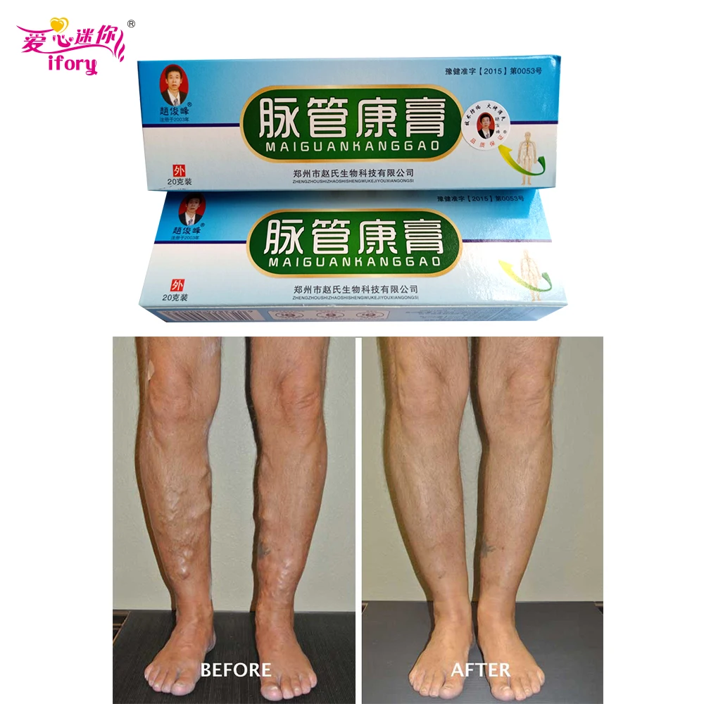 Ifory 2 короба Крем для лечения варикозного расширения вен китайский пластырь против васкулита ног Phlebitis травяной продукт медицинский пластырь