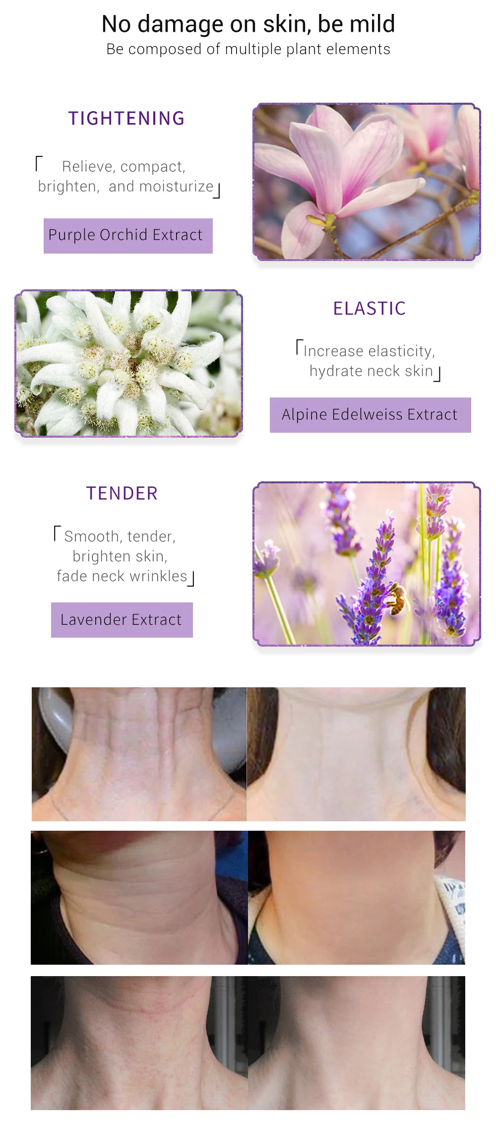 Neck Mild Peeling Beauty
