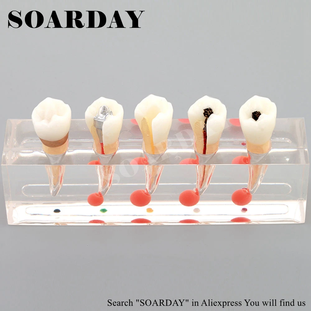 Endodontic Model (3)