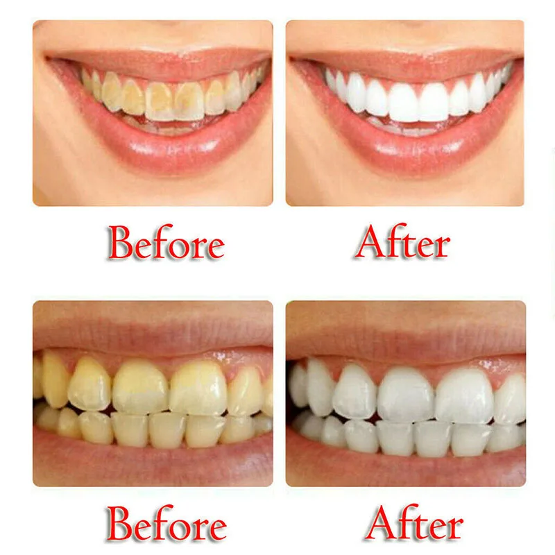 

Intensive Stain Removal Whitening Toothpaste Fight Bleeding Gums for Brushing Teeth YUF99