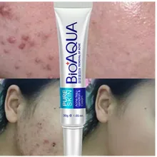 1pc Skin Care 30g Acne Treatment Blackhead Remova Anti Acne Cream Oil Control Shrink Pores Acne Scar Remove Face Care Whitening meiking face cream acne treatment moisturizing whitening hydrating shrink pores skin care collagen day creams acne scar remove