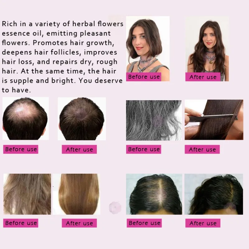 Травяной рост волос эфирное масло ремонт волос способствует росту волос для женщин и мужчин волосы Сыворотка для роста