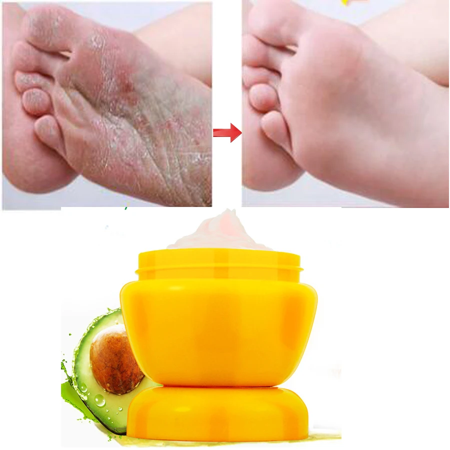 Ecophy Hand Foot Crack Cream Heel Chapped Peeling Foot Hand Repair Anti Dry Crack Skin Chinese Medicinal Ointment Cream