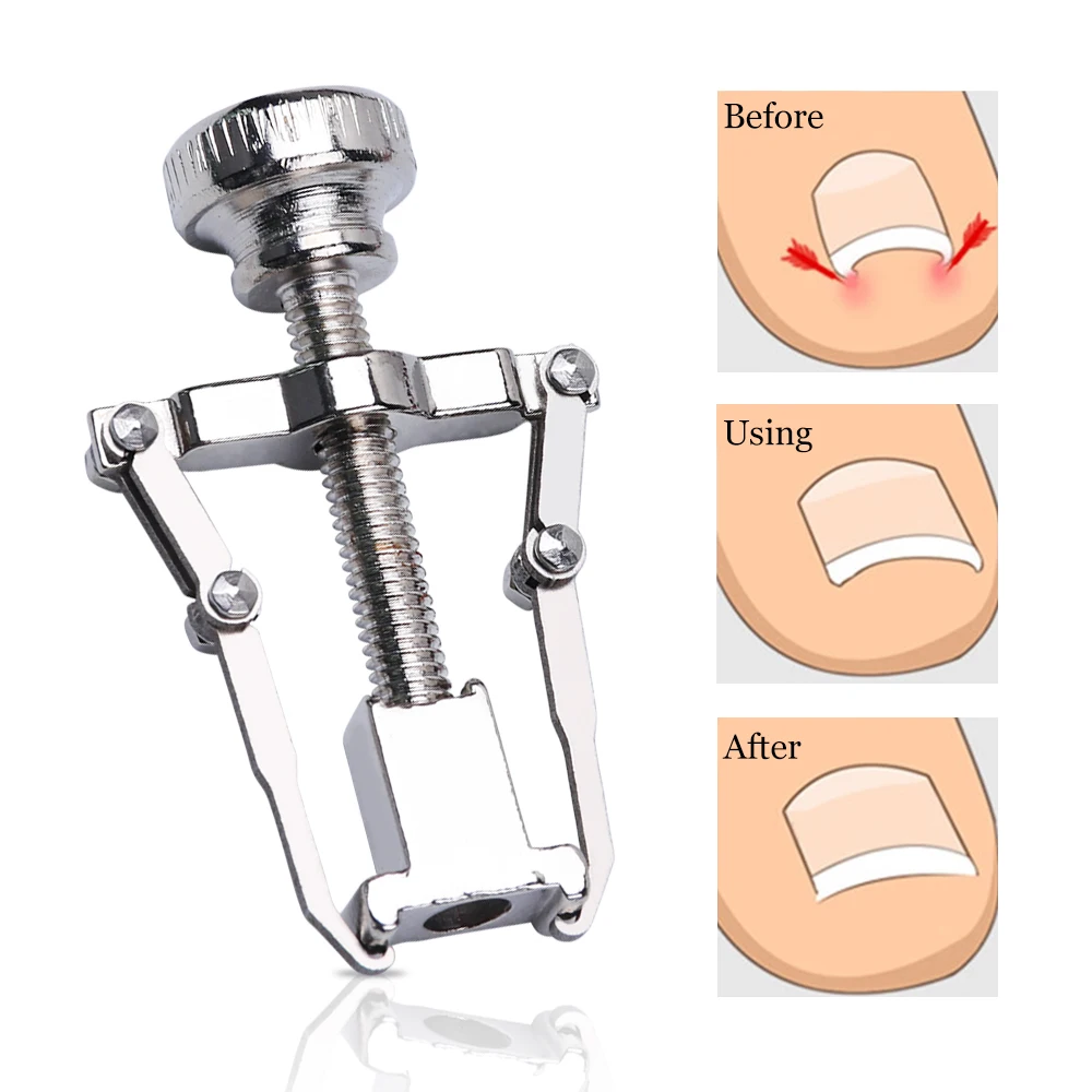 

1pc Recover Correction Clipper For Ingrwon Toenails Pedicure Foot Care Tool Orthotic Curvy Toe Nails Fixer Paronychia Nail LA743