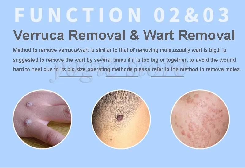 mole-removal-machine-7