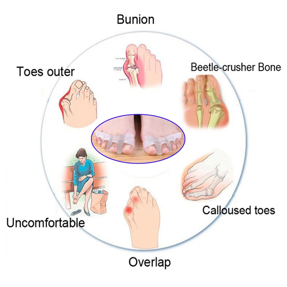 1 пара гелевый силиконовый корректор буйона разделители большого пальца ноги выпрямитель для ухода за ногами деформация вальгусной деформации Профессиональный массажер Z32701