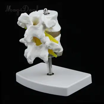 

2-Section Life-Size Human Lumbar Vertebrae Model with Base Medical Teaching Aids