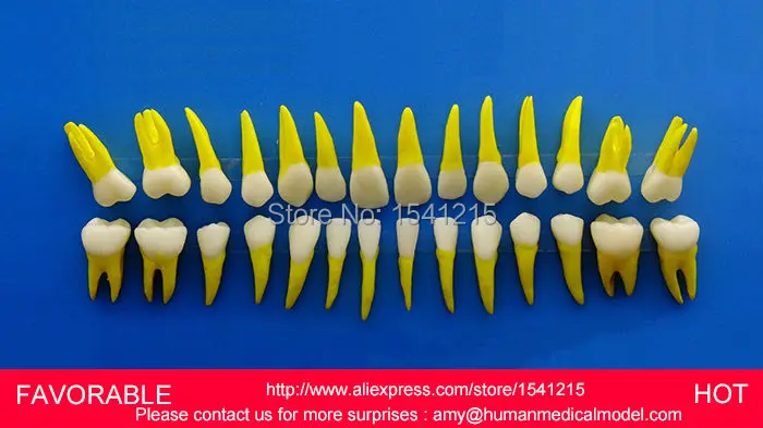 

DENTAL CARIES MODEL,DENTAL DENTAL MODEL ,DENTAL CAST MODEL FOR DEPARTMENT ,PROPORTIONAL SIMULATION MODEL TEETH-GASEN-DEN033