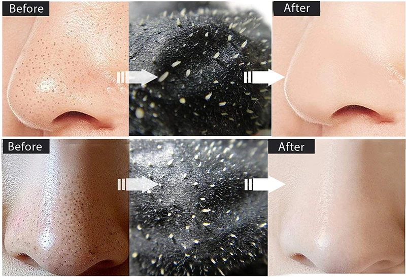 Efero 1 шт. маска от угрей для ухода за кожей лица маска blackhead Remover черный маски пилинг пор полосы маска для носа лечение акне уход