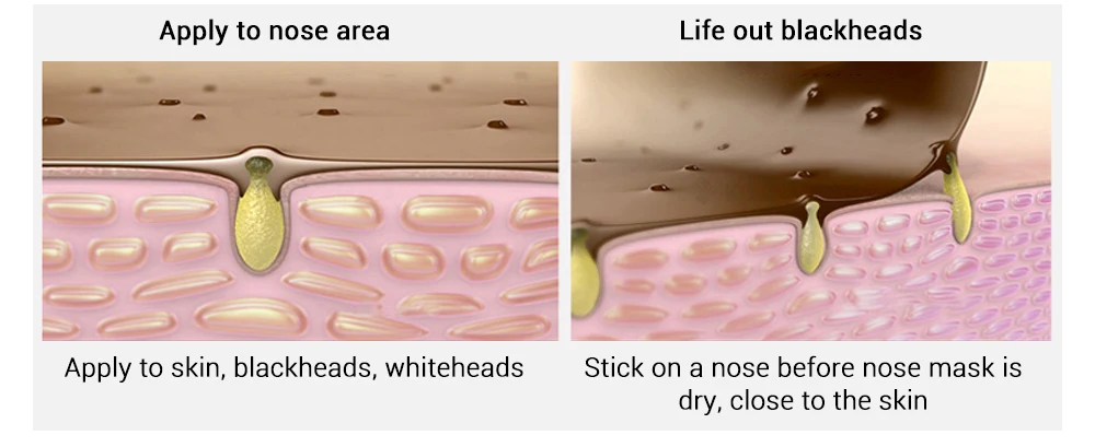 Черная маска LANBENA, маска для лица от черных точек, средство для удаления черных точек, средство для ухода за кожей, грязевые полоски для носа, лечение акне, маска для удаления пор