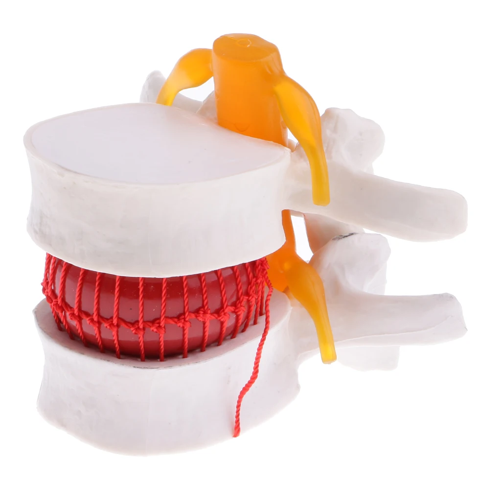 2PCS Magnify 2 Times Human Spine Lumbar Vertebrae Degenerative Disc Skeleton Model Educative Science Toy Lab Study Kits