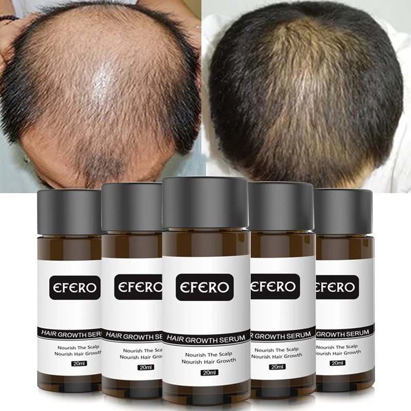 

Hair Growth Serum Essence for Women and Men Anti Hair Loss Shampoo Preventing Baldness Essential Oil Hair Care Products 20ml