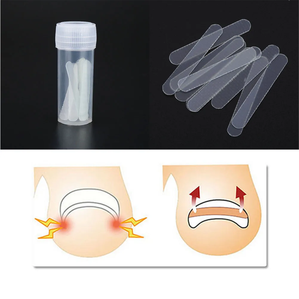

10pcs Ingrown Toenail Straightening Clip Curved Sticker Patch Thick Toenail Paronychia Correction Corrector Foot Pedicure Tools