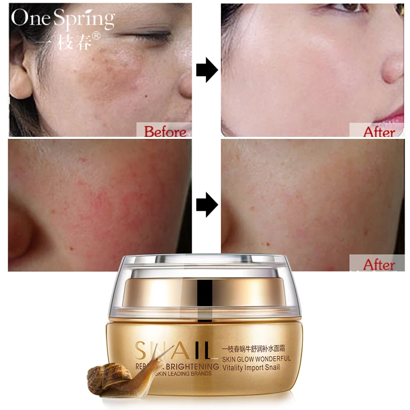 

Onespring Moisturizing Cream Remove Age Spot Scar Pigment Whitening Anti Wrinkle Cream Beauty Miracle Glow Day & Night faceCream