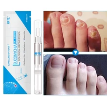 Ручка для лечения грибок ногтей, удаляет онихомикоз, паронихию, против грибковой инфекции ногтей, для рук и ног, жидкость для ухода за кожей 3 мл