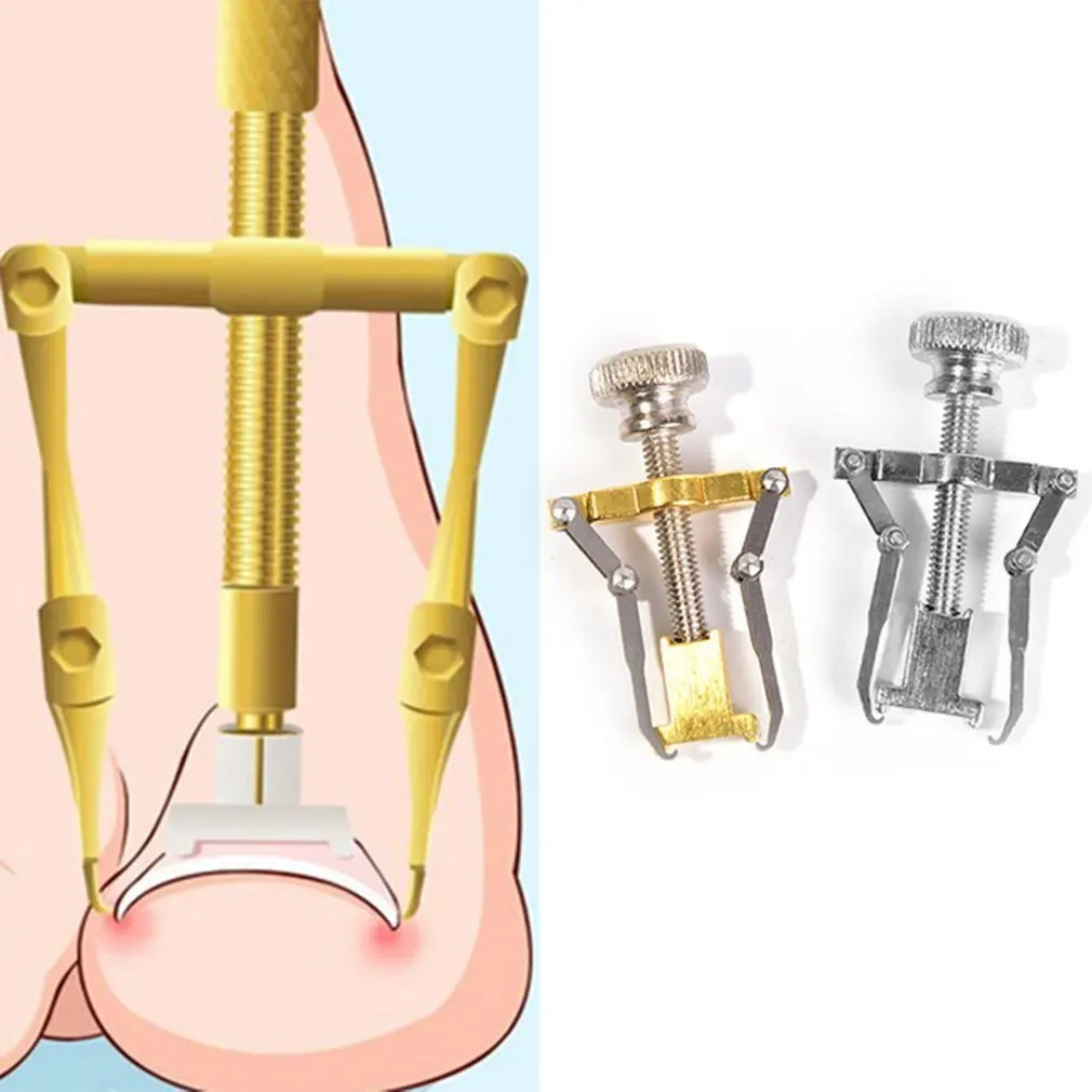 

Ingrown Toe Nail Correction Tool Manicure Clipper Pedicure Fixer Recover Pro Foot Nail Care Orthotic Nail Bunion Corrector