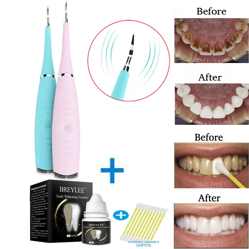 Portable Electric Sonic Dental Scaler Tooth Calculus Remover Tooth