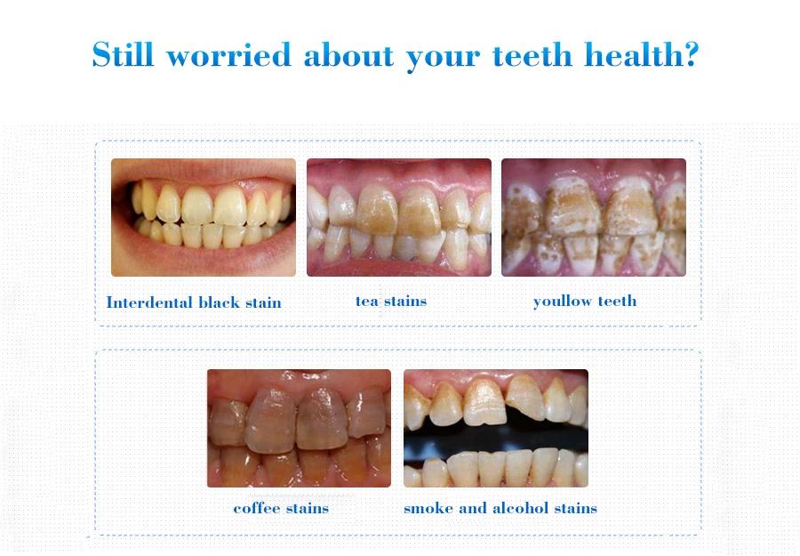 Гигиена полости рта Отбеливание зубов пудра с эссенцией Чистящая сыворотка удаляет зубной налет пятна Отбеливание зубов белый зуб стоматологические инструменты