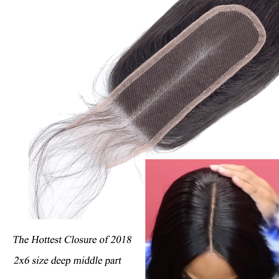 bundles with closure 4