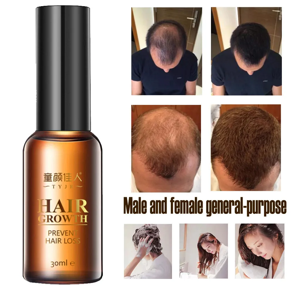 Hot 2018 New Fashion Hair Growth Essence Advanced Thinning Hair
