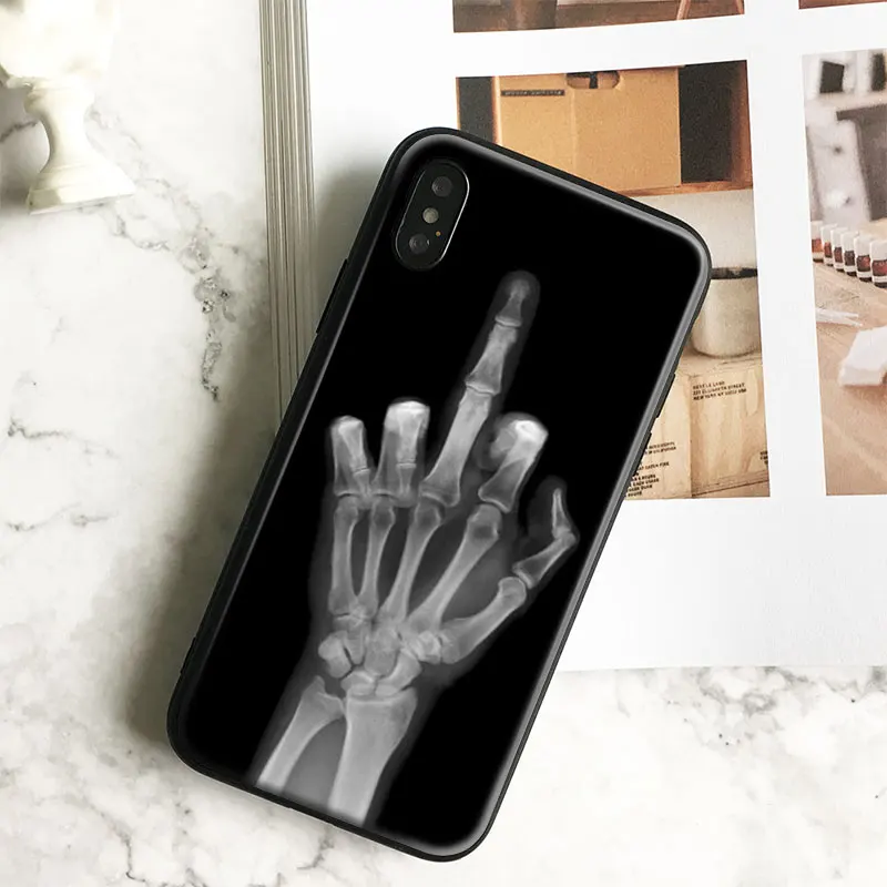 

Cool X-Ray Middle Fingere Coque Free Hang Rope Tpu Soft Silicone Phone Case Cover Shell Bag For Apple iPhone 5 SE 5S 6 6S 7 PLUS