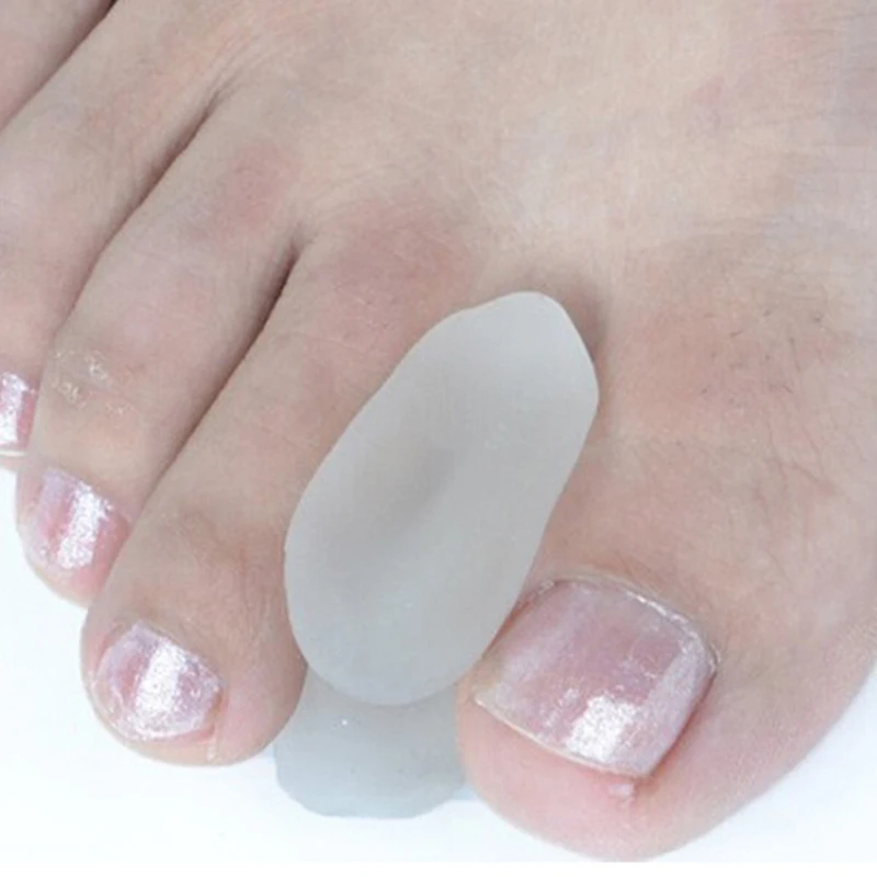 Silicone toe separador, cuidados com os pés, hálux valgo, pedicure corretor, cuidados com os pés, osso, polegar, protetor, 2pcs