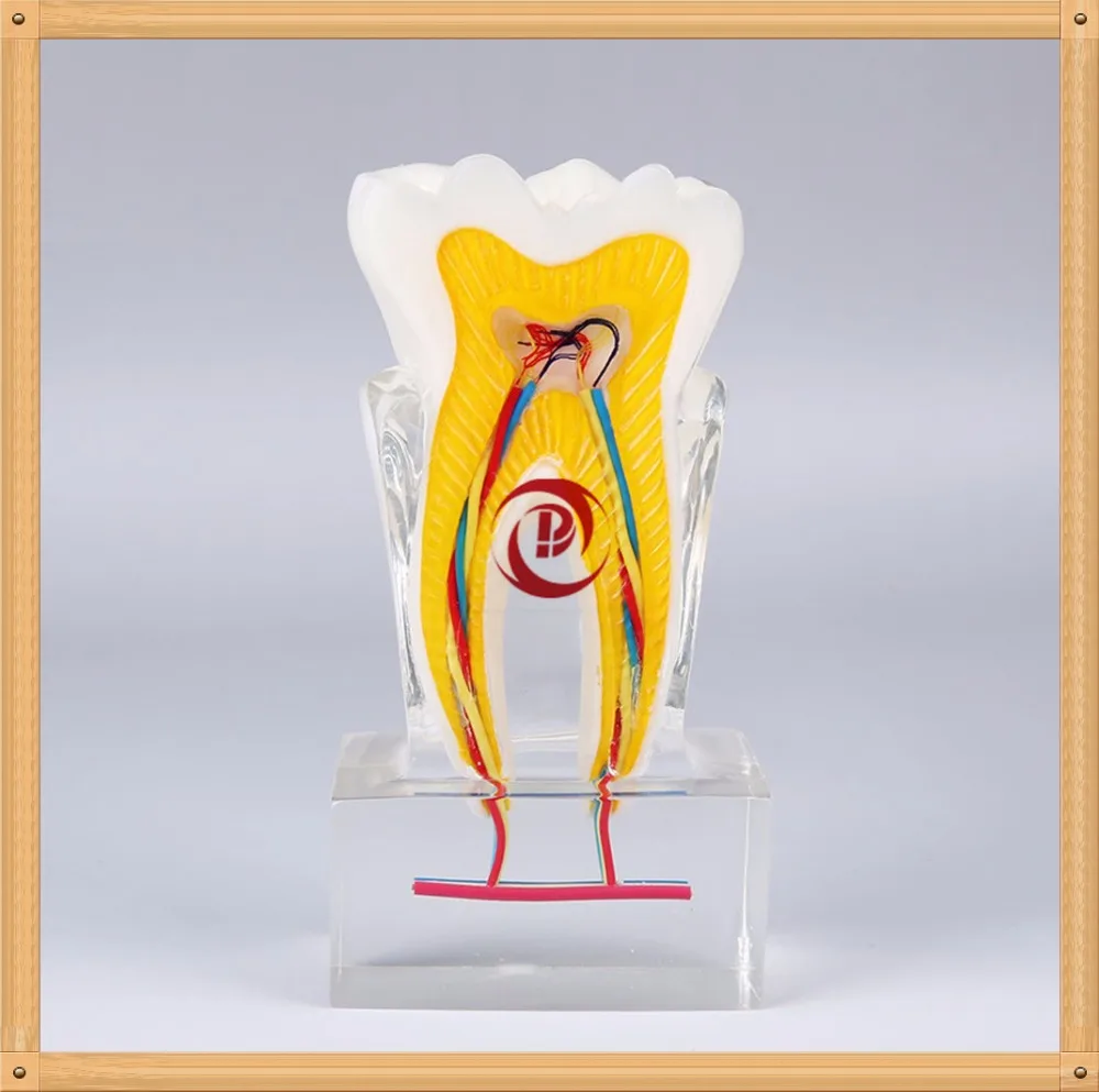 

Dental Teeth Model/Dentistry Education model/Pathological tooth model/Tooth nerve dissection