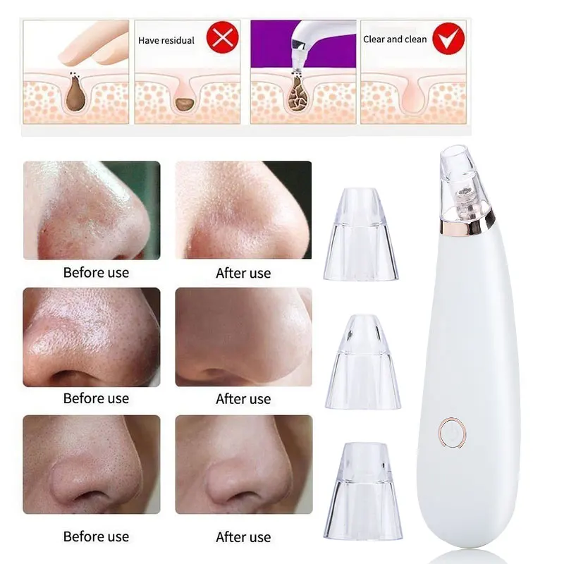 

2019 Drop Shpping ABS Black Head Cleaner Blackhead Removal Equipment Fast Effective Beauty Health Blackhead Beauty Apparatus