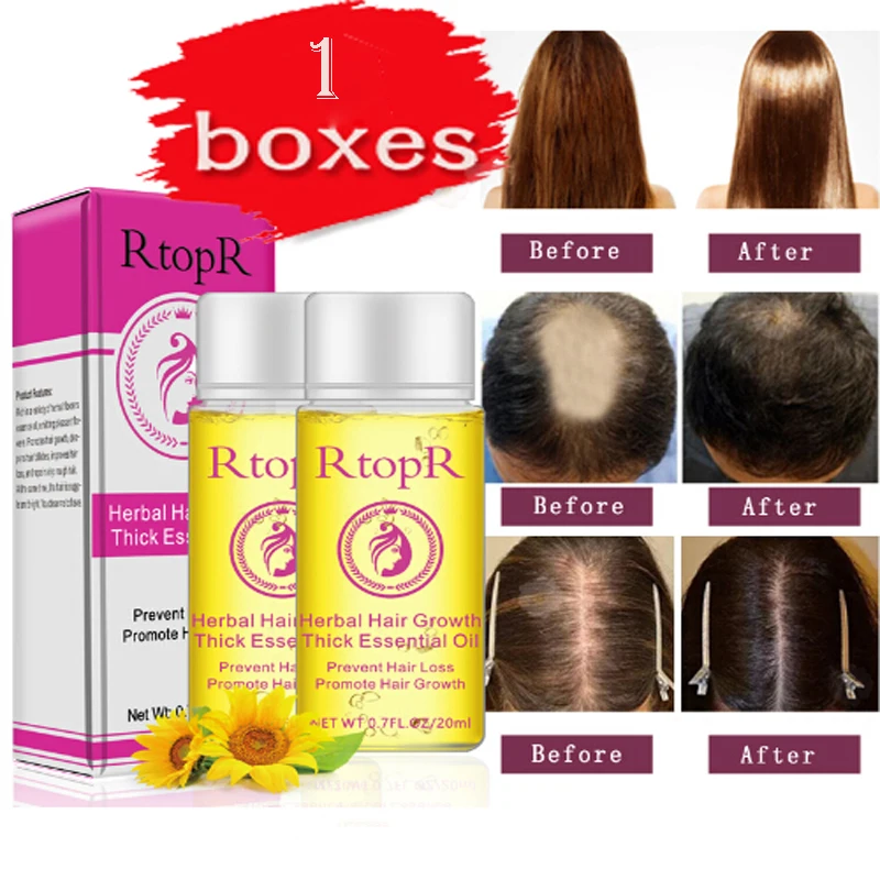 

20ML Hair Growth Essence Products Essential Oil Liquid Treatment Preventing Hair Loss Hair Care Repair Treatment Conditioners