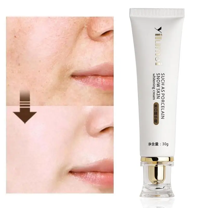 

Whitening Skin Bleaching Cream Moisturizing Blemish Whole Body Lotion Legs Knees Private Parts Body Whitening Essence Cream