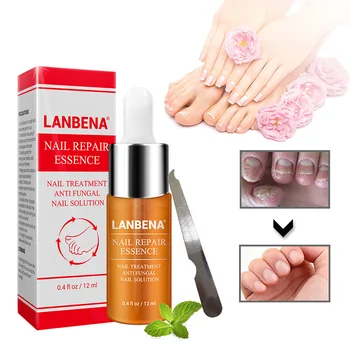 

Removal Fungus Healthy Repair Essence Nail Treatment Tools With Nail File Nail Foot Protector Skin Care Essence Serum