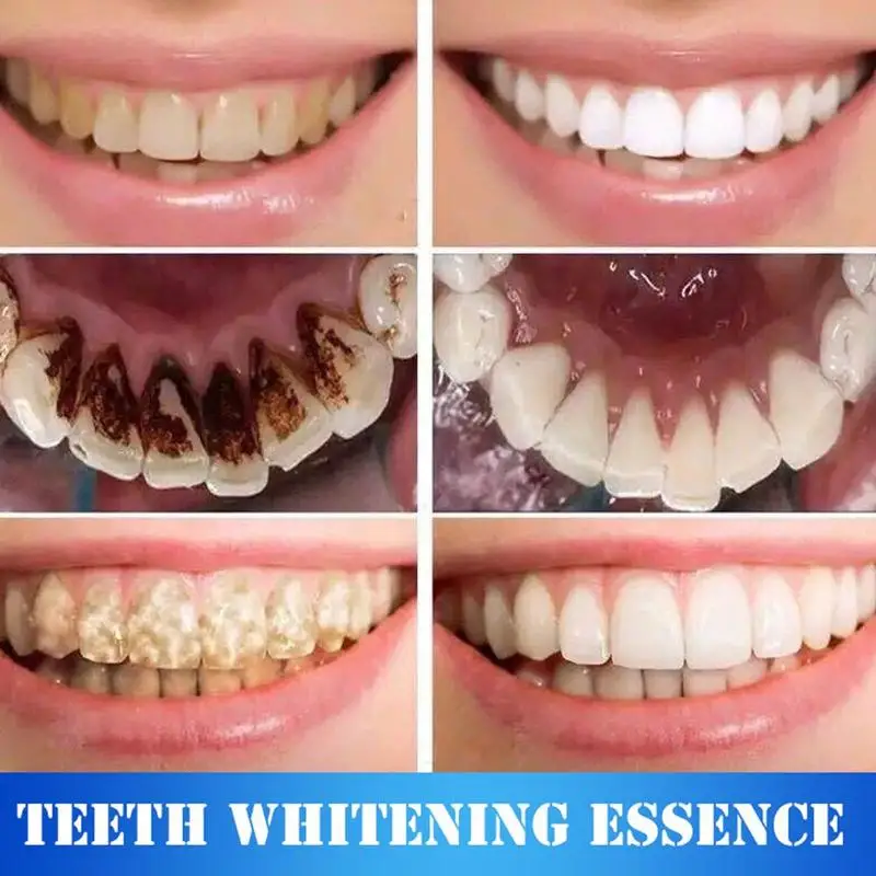 LANBENA отбеливание зубов пудра с эссенцией гигиена полости рта Очищающая сыворотка удаляет пятна налета отбеливание зубов