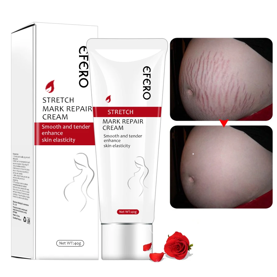 EFERO крем для восстановления кожи тела для беременных, Крем Для Удаления растяжек и шрамов после родов, сыворотка для беременных, кремы для гладкой кожи