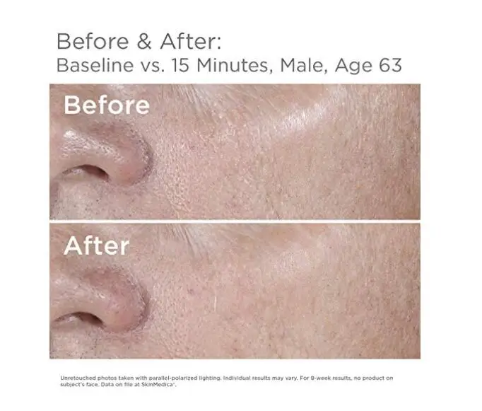 “ 2019 New Arrival Ha5 Rejuvenescimento