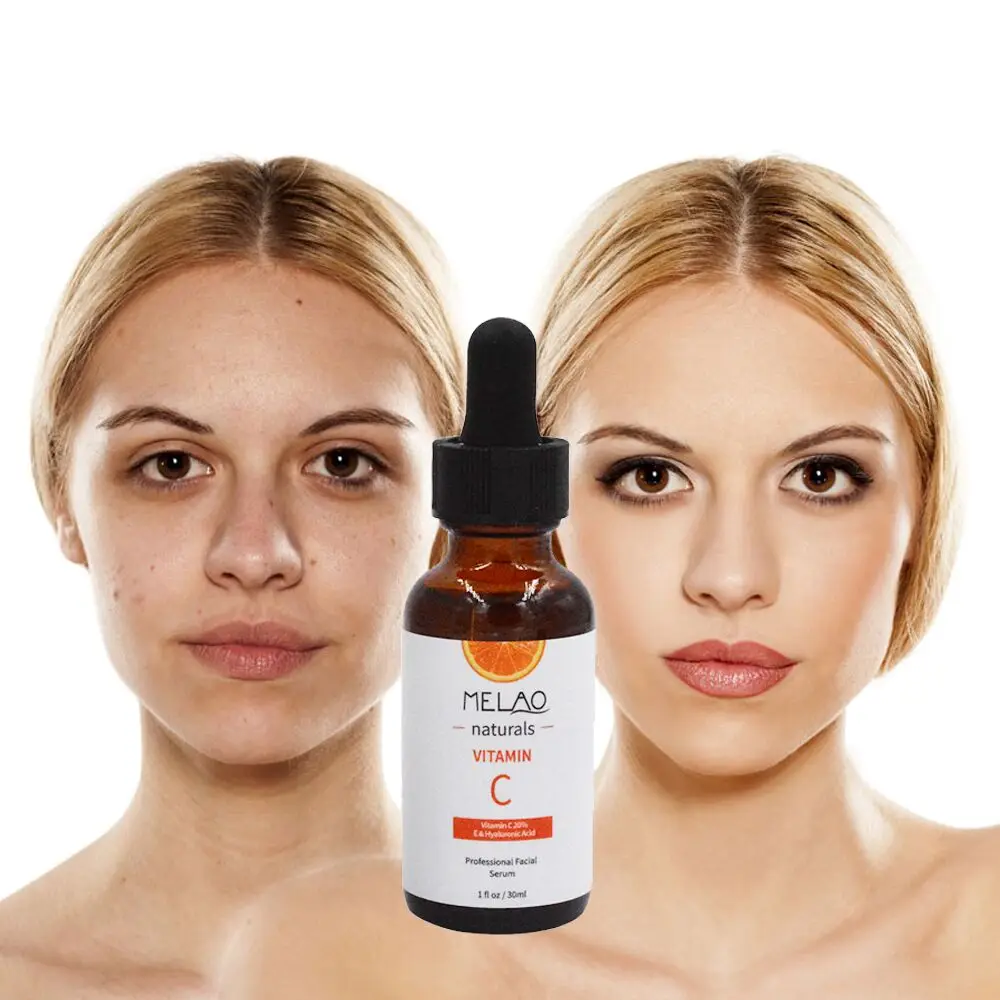 melao serum