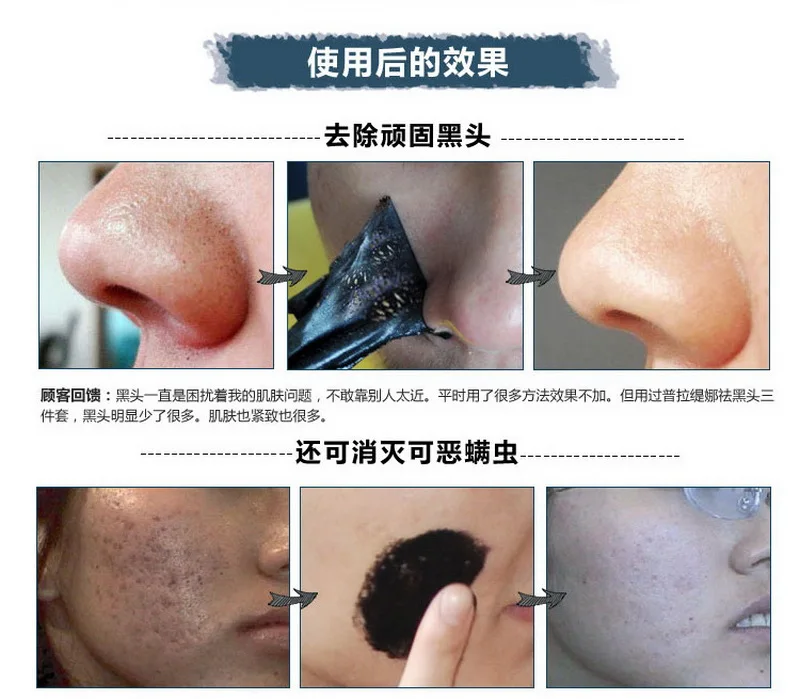 Через dhl или ems, 2000 штук лучшая помада skinaz черная маска для лица маска blackhead для глубокой очистки кожных пор полоски чистая кожа