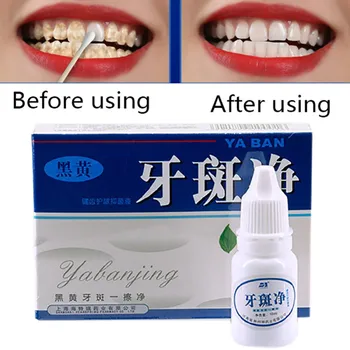 

Pure plant extract Teeth whitening quick effect to yellow dental plaque tattoo black stained toothpaste liquid toothpast