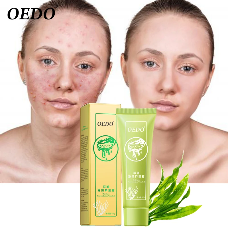 Водоросли алоэ вера гель увлажняющий отбеливающий день кремы Acne антивозрастной
