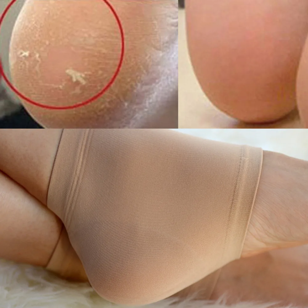 

2pcs/1Pair Gel Heel Socks Like Cracked Foot Skin Care Protector Silicone Moisturizing Health Feet Protect Size L Foot Care Tool