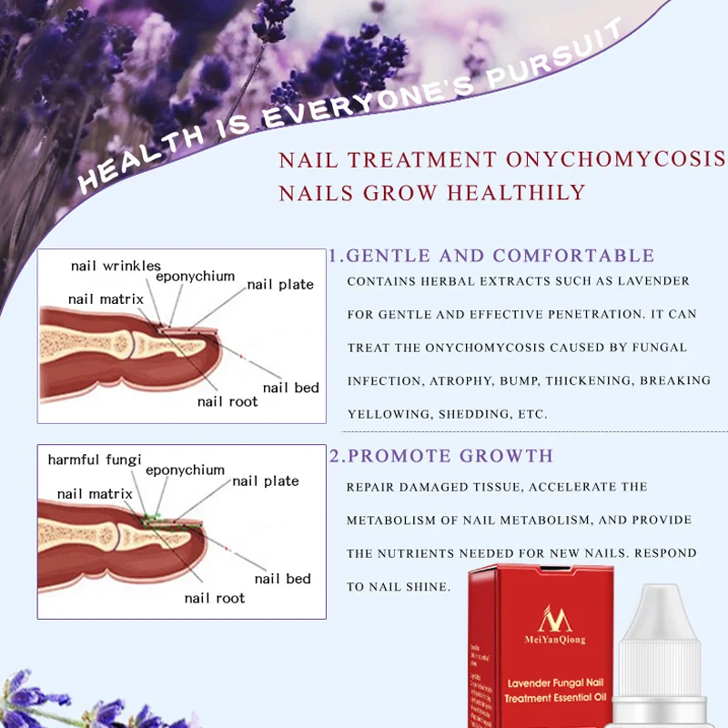 Effective Nail Fungus Treatment Anti Fungal Toenail Repair Lavender Essential Oil Nail Care Onychomycosis Treatment Liquid JLRS8 Effective Nail Fungus Treatment Anti Fungal Toenail Repair Lavender Essential Oil Nail Care Onychomycosis Treatment Liquid JLRS8