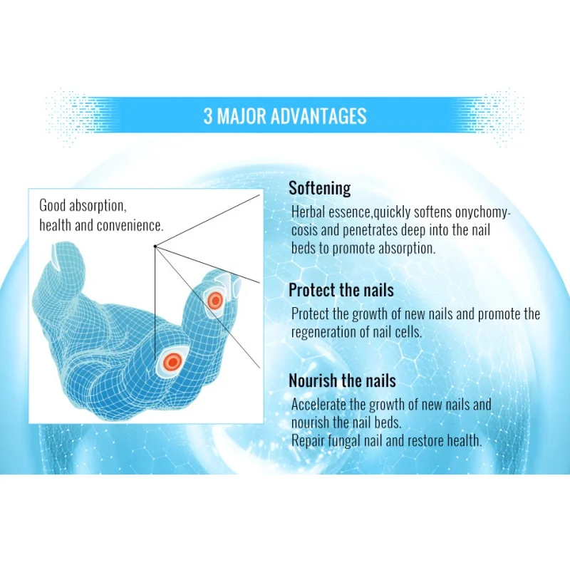10 мл натуральные Лечение ногтей от грибка эссенция для ногтей ноги отбеливающий носком ногтей Удаление грибка гель анти-инфекция паранихия
