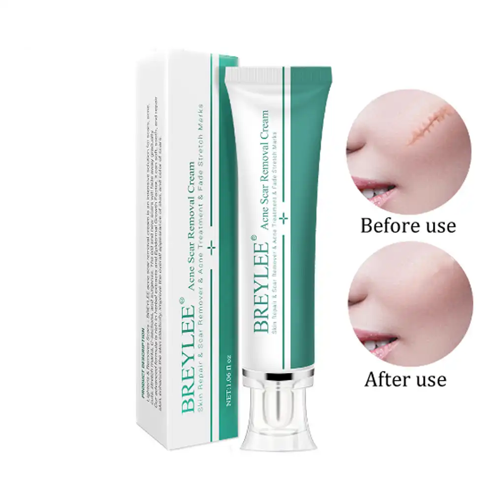 face cream for spot removal