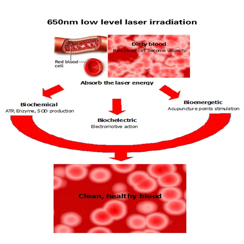 Automatic laser watch diabetes machine acupuncture device In frared blood circulation massager Laser therapy instrument