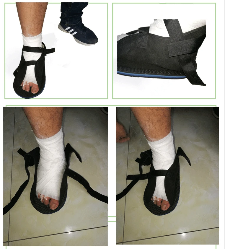 Foot Injury Ankle Fractures Trauma Rehabilitation Surgical Shoes Gypsum shoes